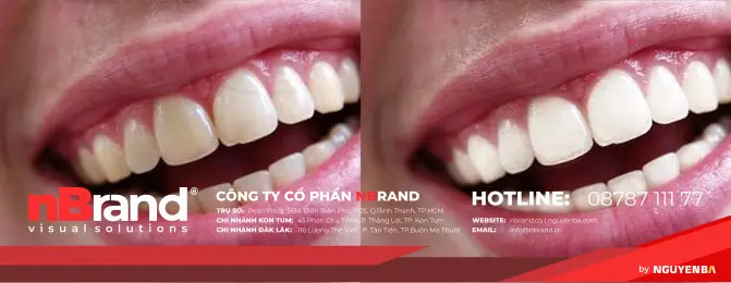 Chia sẻ 10 bộ action bắt buộc phải có dành cho Photoshop 16 10-action-tuyetdep-photoshop-08